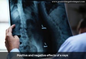 Positive and negative effects of x-rays